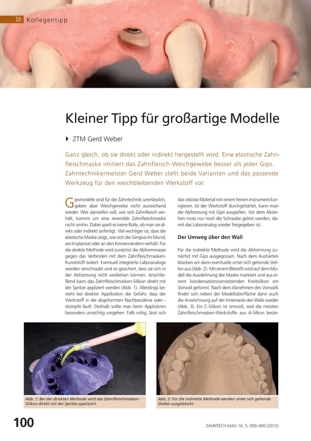 komet-shax-modellfr-ser-zahnfleischmaske-labor image 1