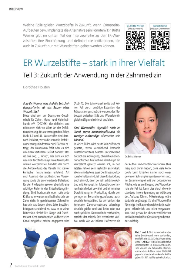 komet-er-system-fachbericht-wurzelstifte-teil-1-endodontie image 1