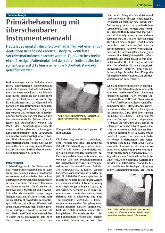 komet-dental-diao-fachbericht-prim-rbehandlung-endo image 1