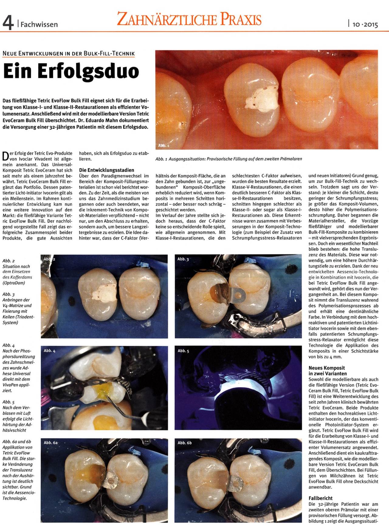 komet-ceracut-composite-f-llung-schallspitzen-fachbericht image 1