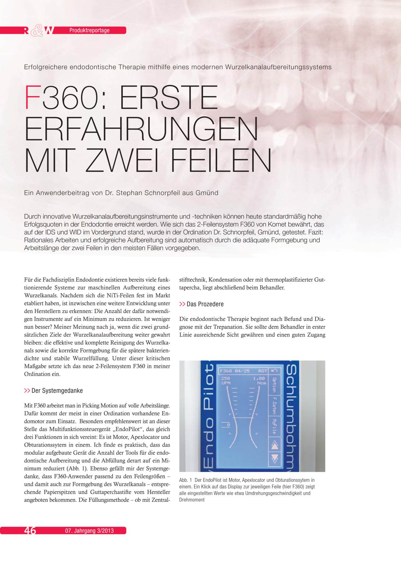 komet-dental-f360-wurzelkanalfeilen-niti-2-feilen-set image 1