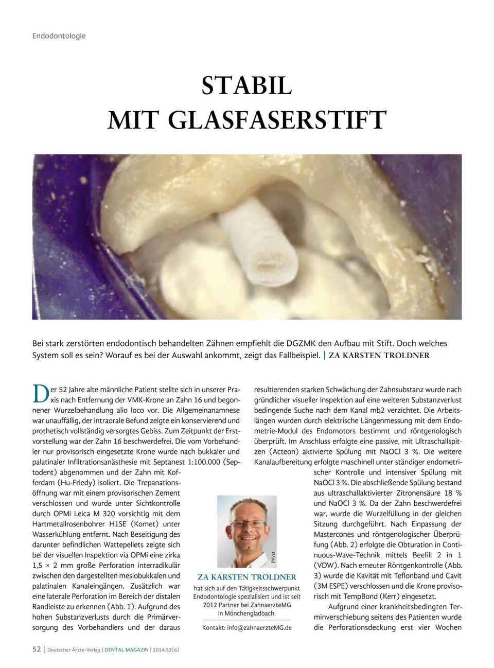 komet-cerapost-stabil-mit-glasfaserstift-fachbericht-endodontie image 1
