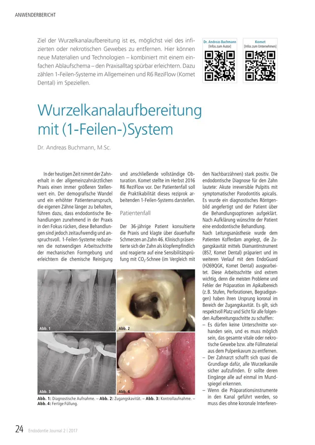 komet-dental-fq-fachbericht-wurzelkanal-1-feilen-system image 1