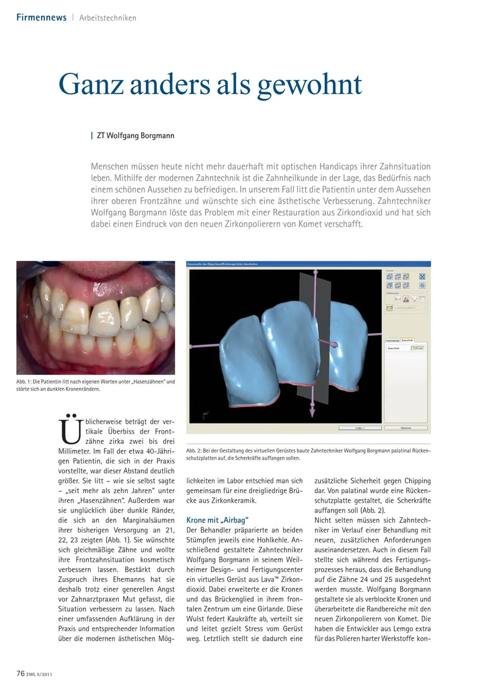 komet-art2-keramikpolierer-diamant-labor-praxis image 1
