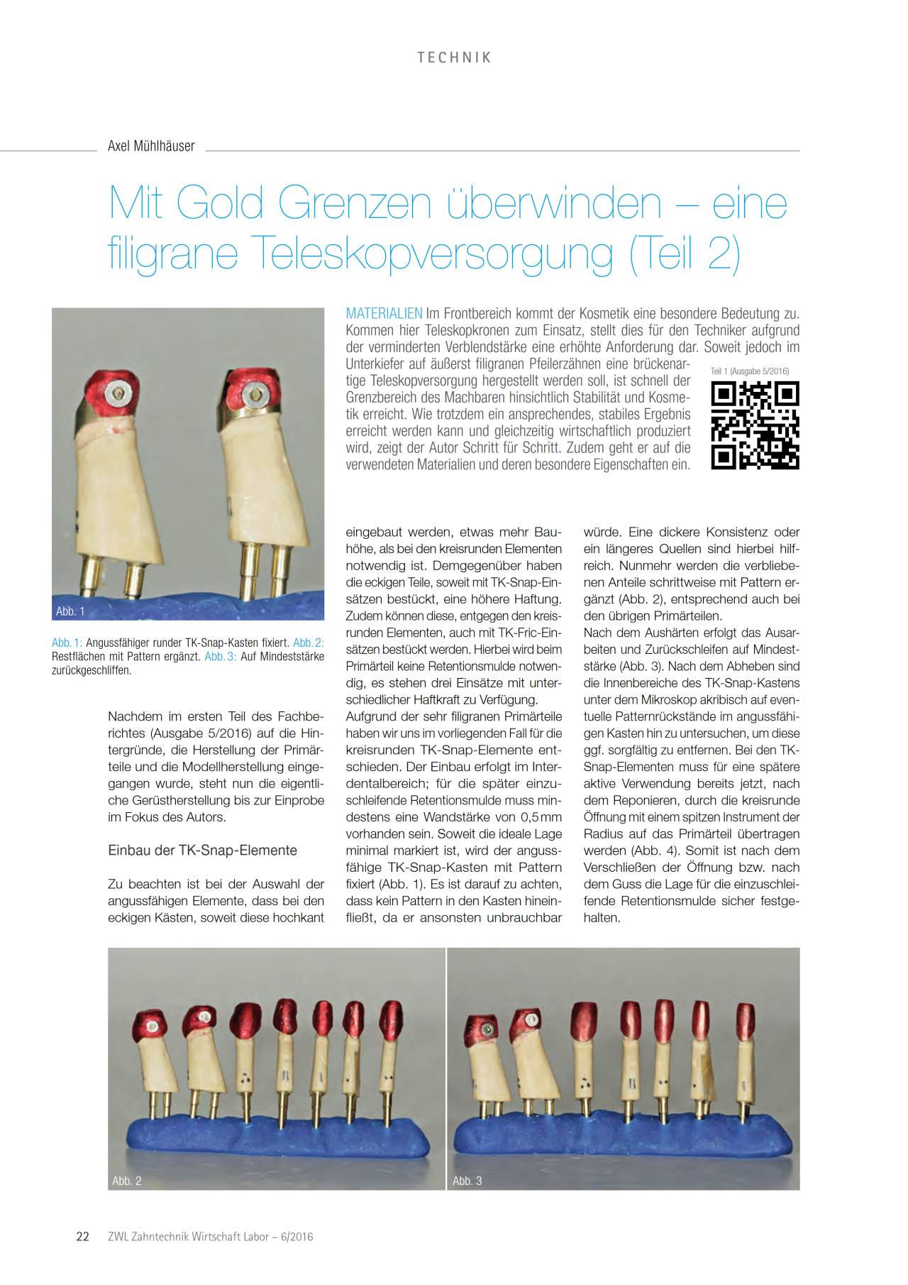 komet-diao-mit-gold-grenzen-berwinden-fachbericht-teleskopversorgung image 1