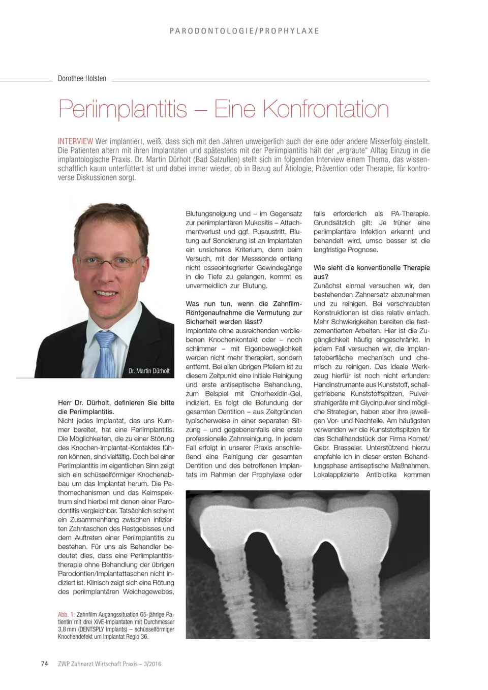 komet-ceradrill-periimplantitis-fachbericht-d-rholt image 1