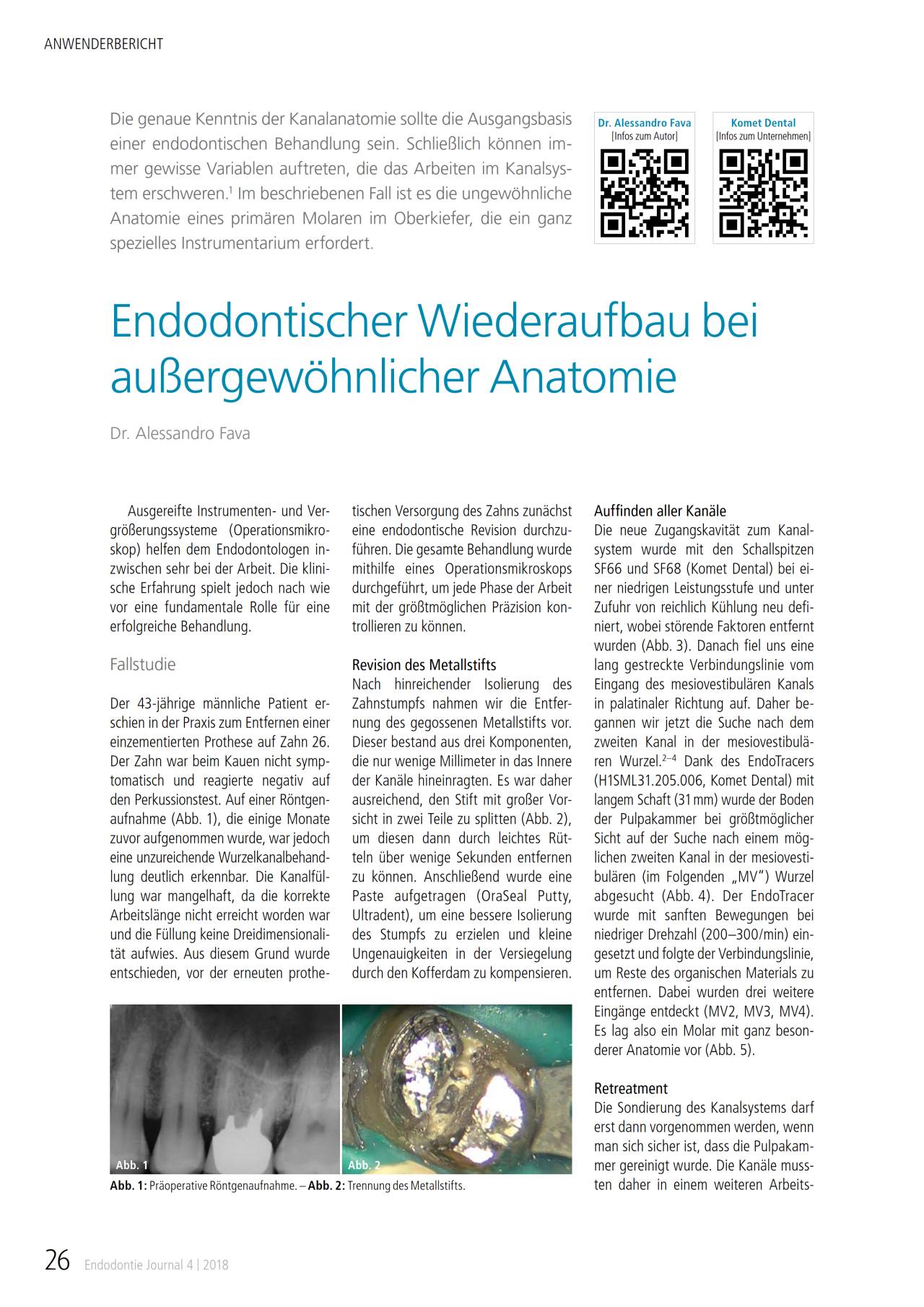 komet-fq-endo-set-wiederaufbau-anatomie-04-2018 image 1