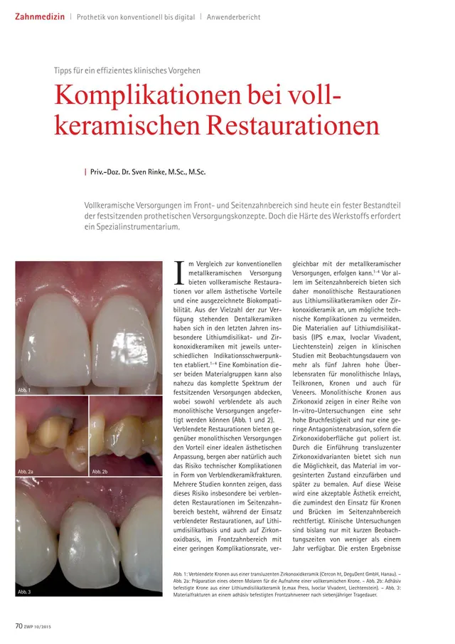 komet-diao-fachbericht-vollkeramik-kronentrenner image 1
