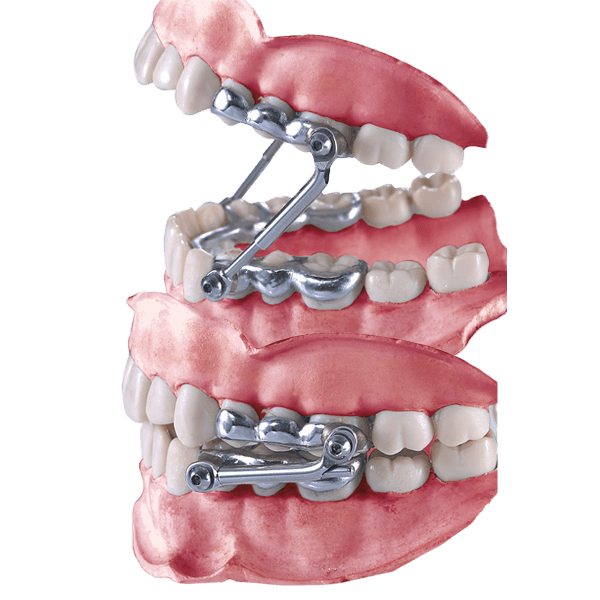 forestadent-klasse-ii-mandibul-res-protrusionsscharnier-apparatur image 2