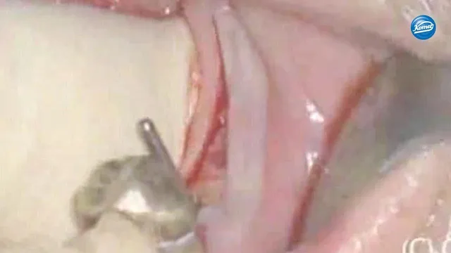 komet-ceradrill-210l16-video-pilotbohrung-implantat image 1