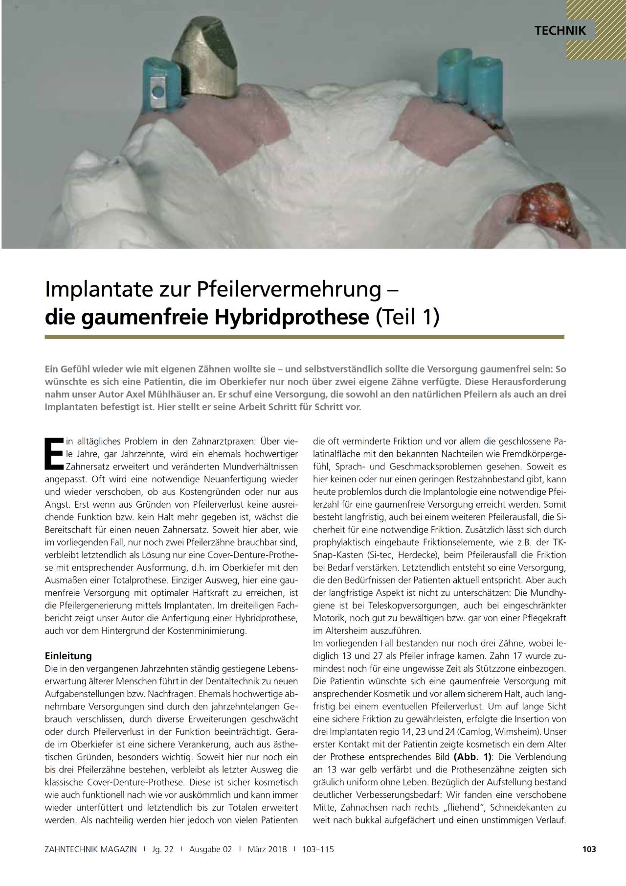 komet-dental-fq-pr-zisionsfr-ser-prothetik image 1