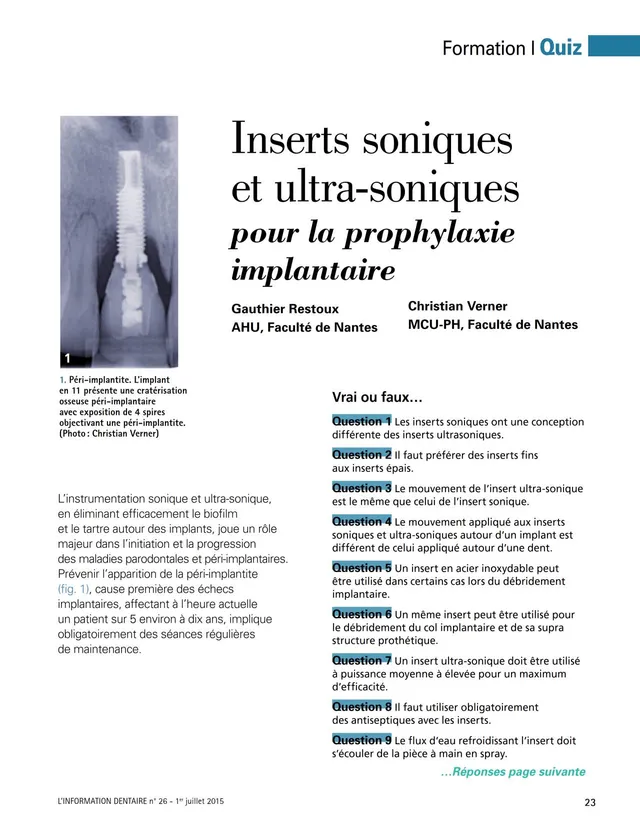 komet-ceradrill-fachbericht-implantat-prophylaxe-quiz-2015 image 1