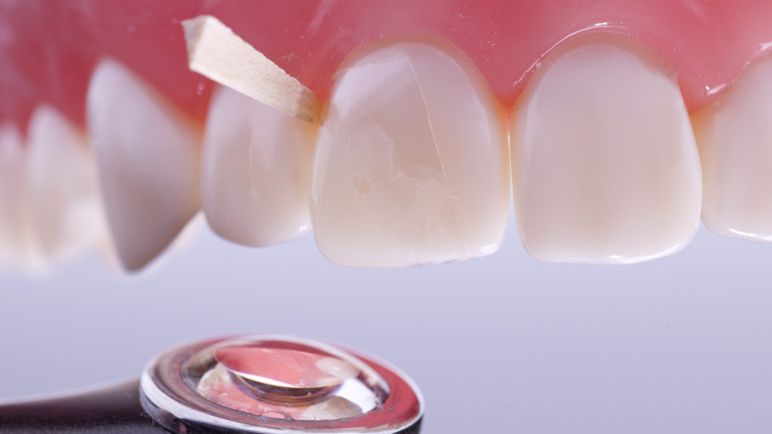 luxator-restorative-coform-matrize-komposit-klasse-iv-transparent image 4