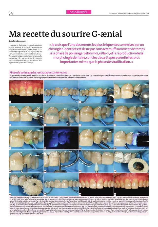 komet-dental-cerapost-fachbericht-politur-restaurationen-anterior-posterior image 1