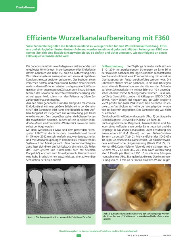 komet-f360-feilensystem-wurzelkanalfeile-iso-55 image 1