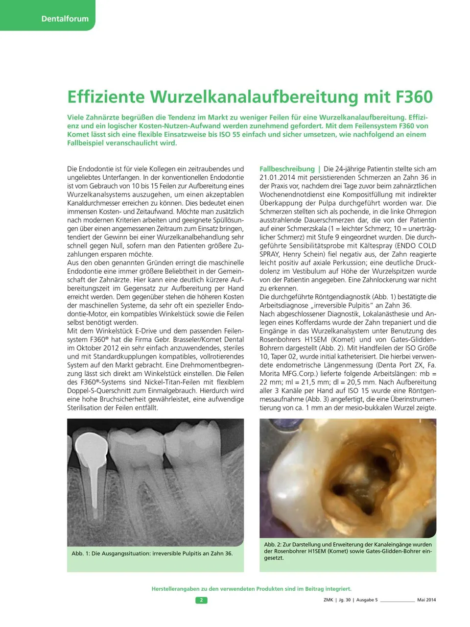 komet-f360-feilensystem-wurzelkanalfeile-iso-55 image 1