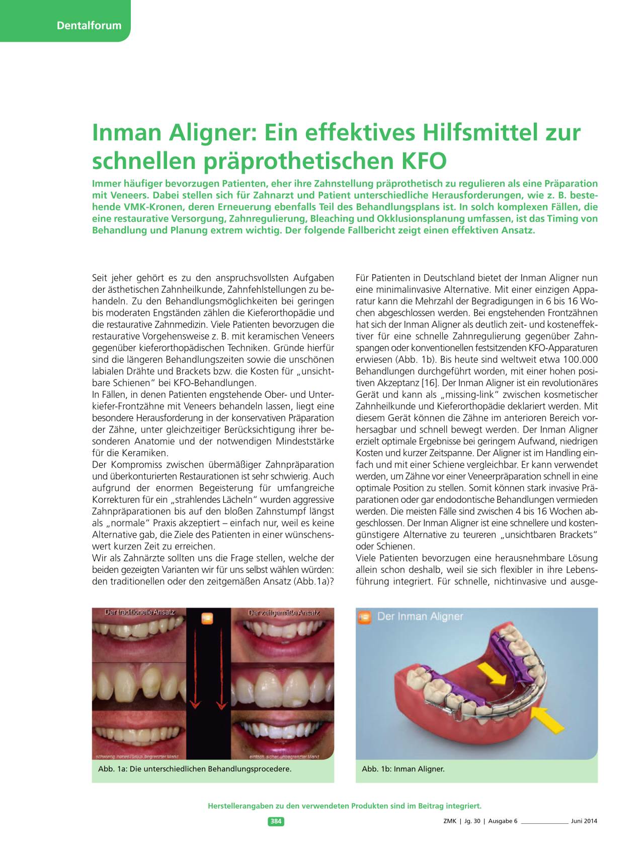 komet-sonicline-hilfsmittel-pr-prothetische-kfo-fachbericht image 1