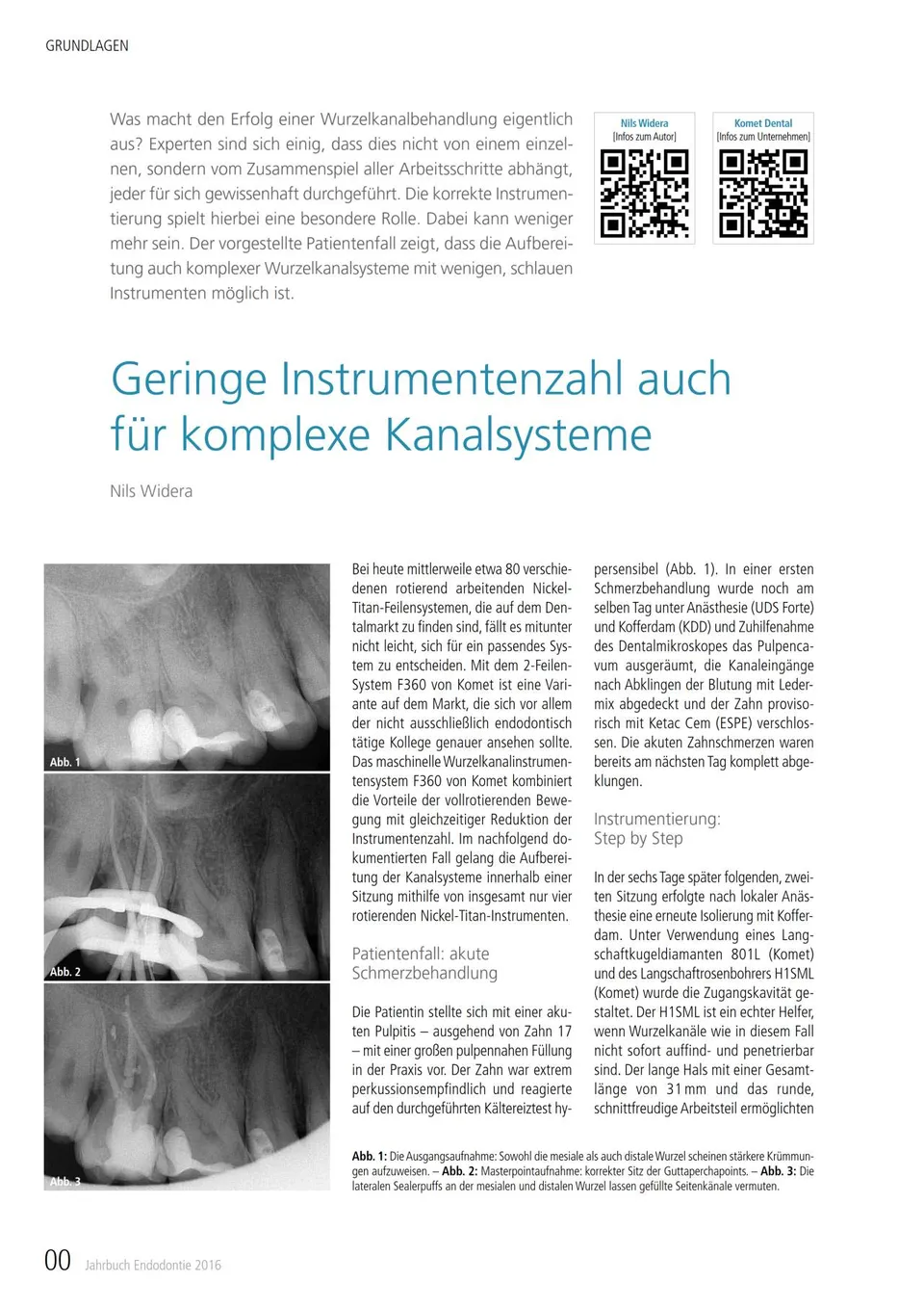 komet-diao-kanalsysteme-fachbericht-widera-2016 image 1