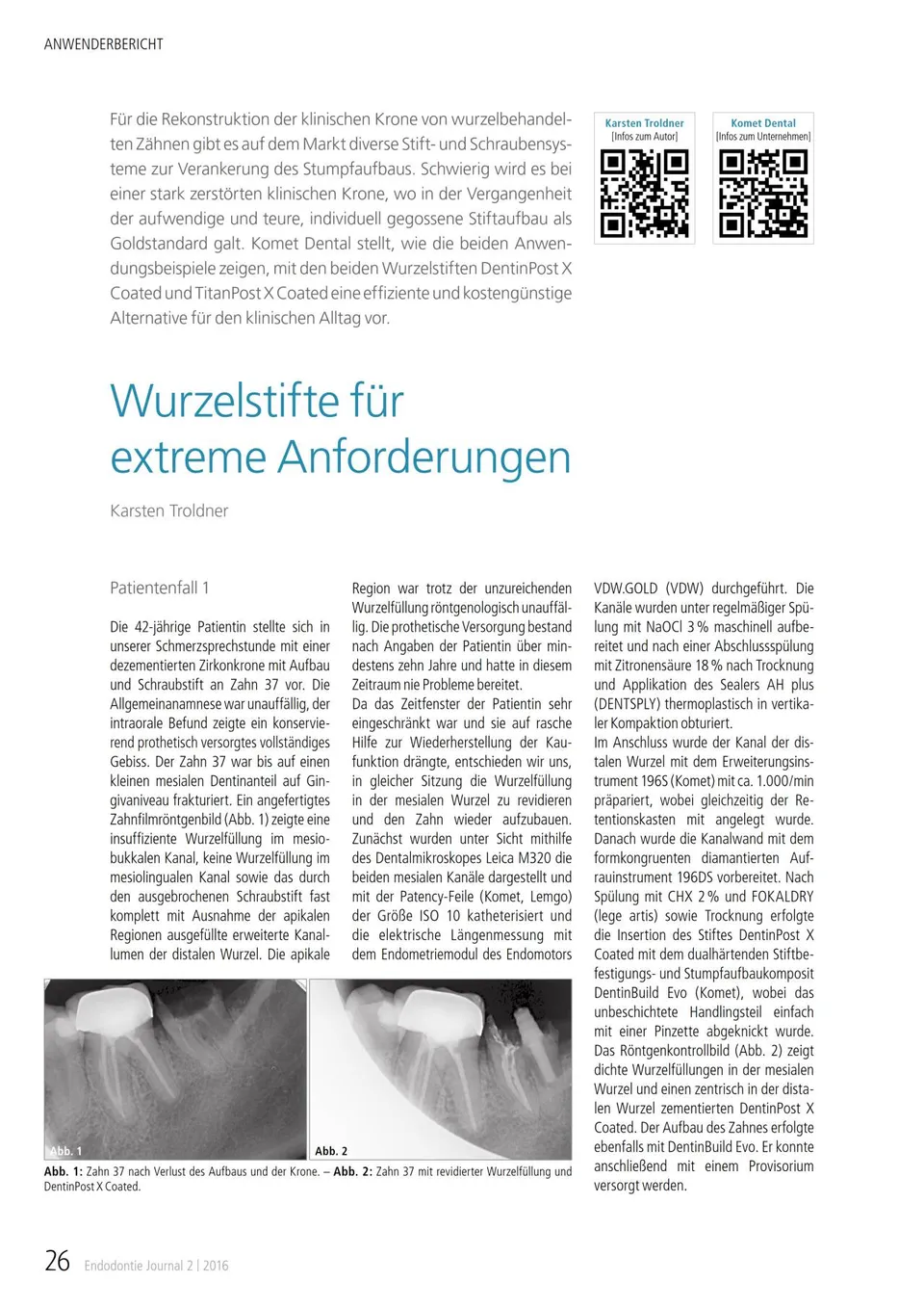 komet-cerapost-fb-wurzelstift-glasfaser-extreme image 1