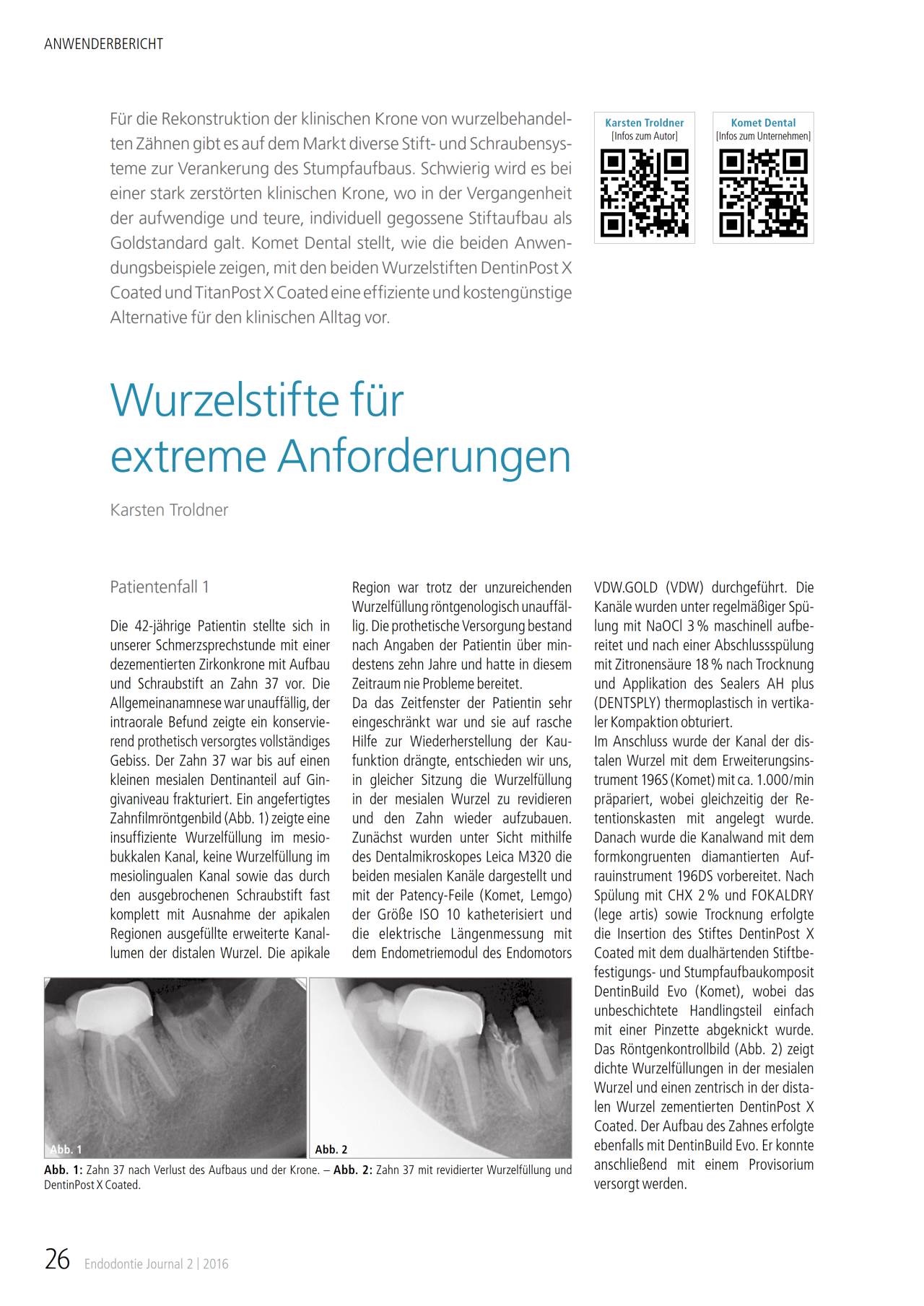 komet-cerapost-fb-wurzelstift-glasfaser-extreme image 1