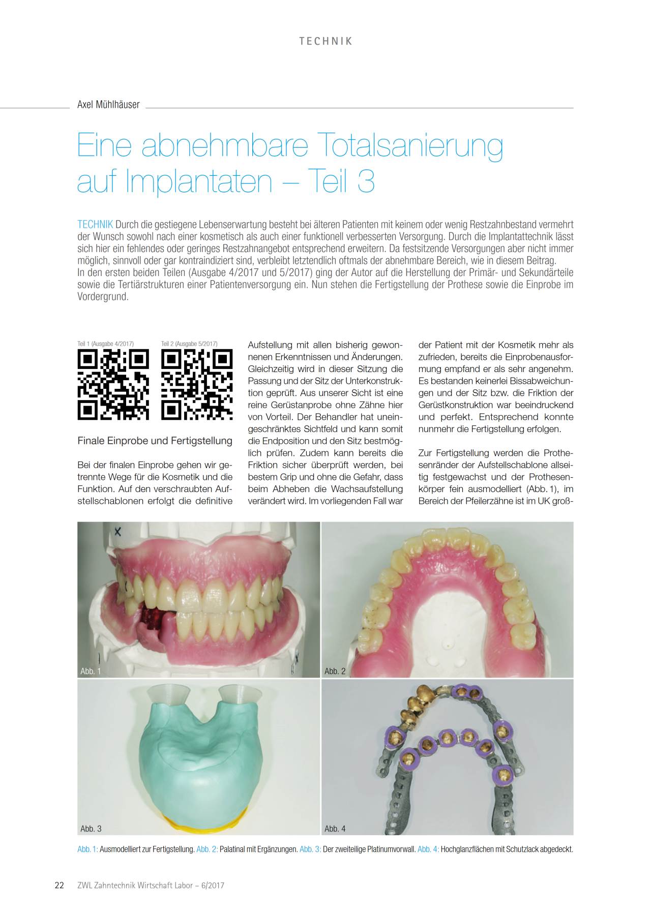 komet-dental-ceradrill-fachbericht-totalsanierung-implantate-teil-3 image 1