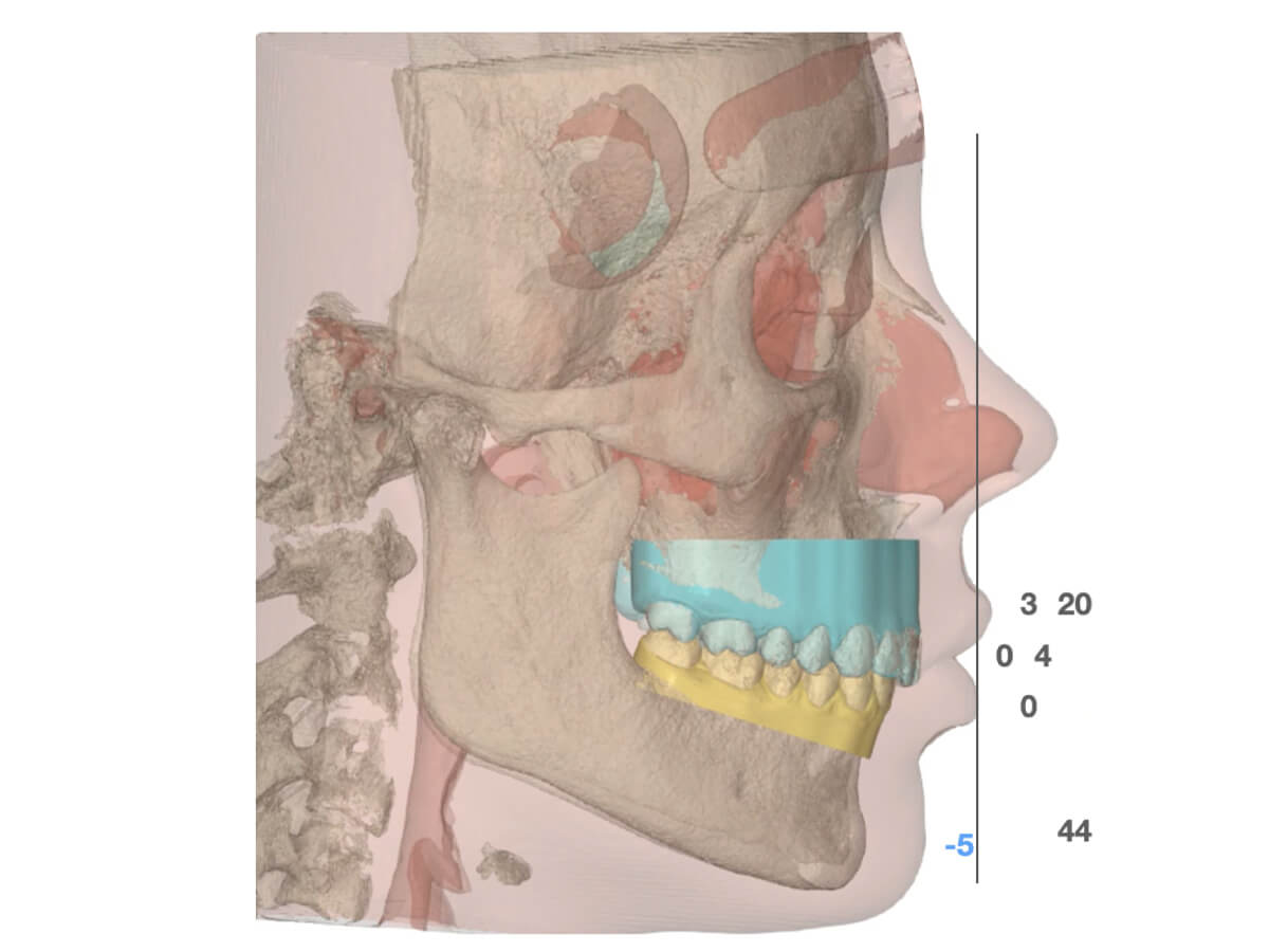 forestadent-fas-aligner-system-digitale-behandlungsplanung-wizard image 4