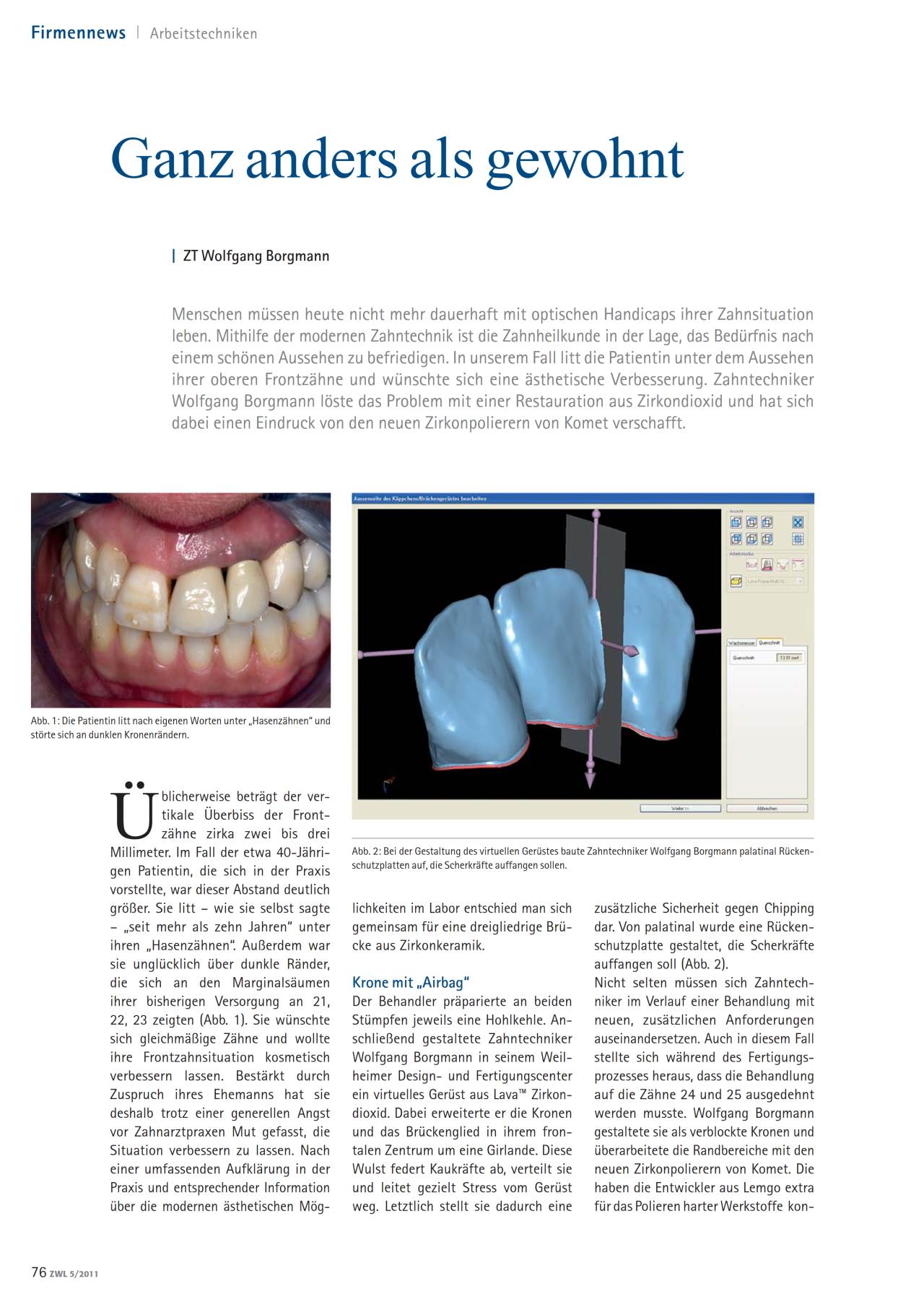 komet-art2-keramikpolierer-diamant-labor-praxis image 1
