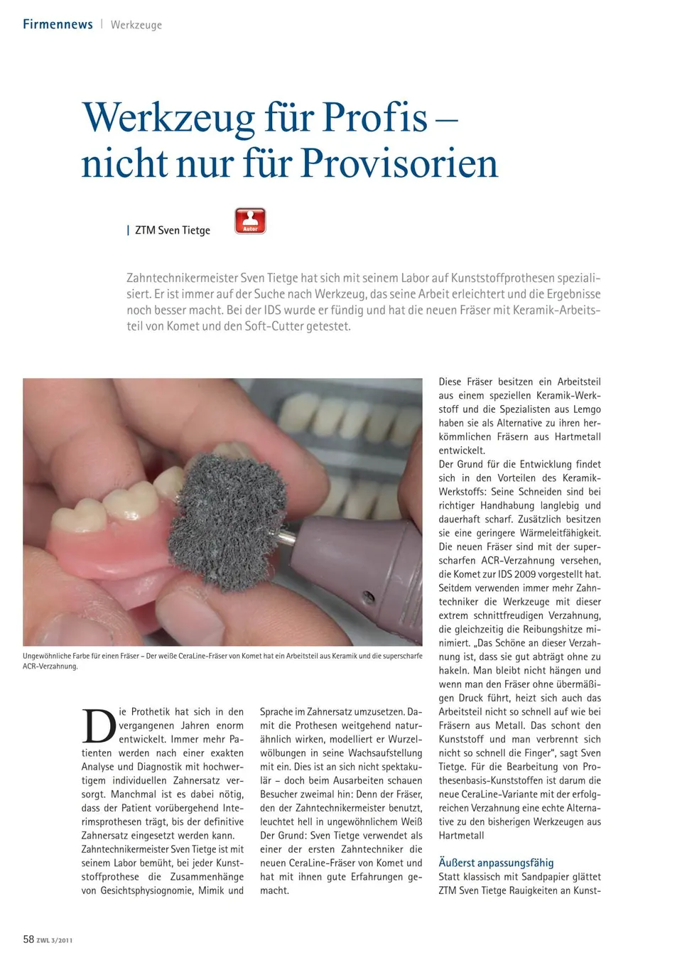 komet-dental-shax-fachbericht-laborinnovationen-ids-provisorien image 1