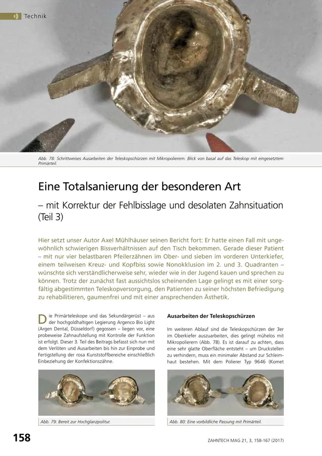 komet-dental-diao-fachbericht-totalsanierung-teil-3 image 1