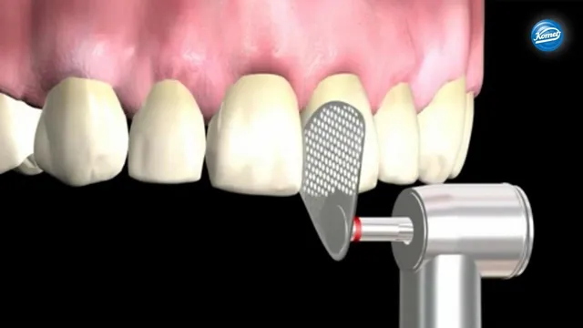 komet-dental-diao-os-scheibe-schmelzreduktion-approximal image 1
