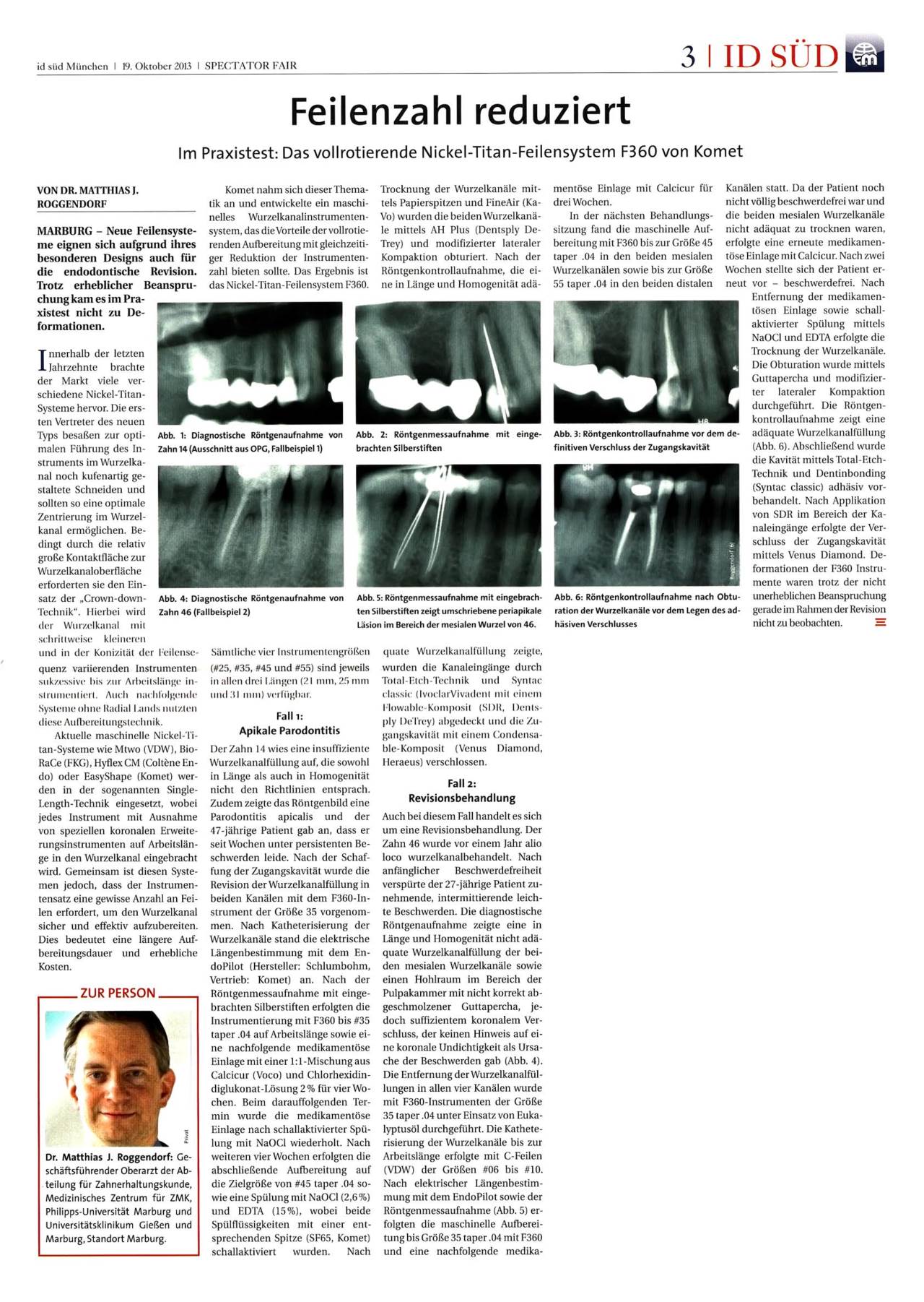 komet-f360-feile-wurzelkanalfeile-niti-2-feilen-system image 1