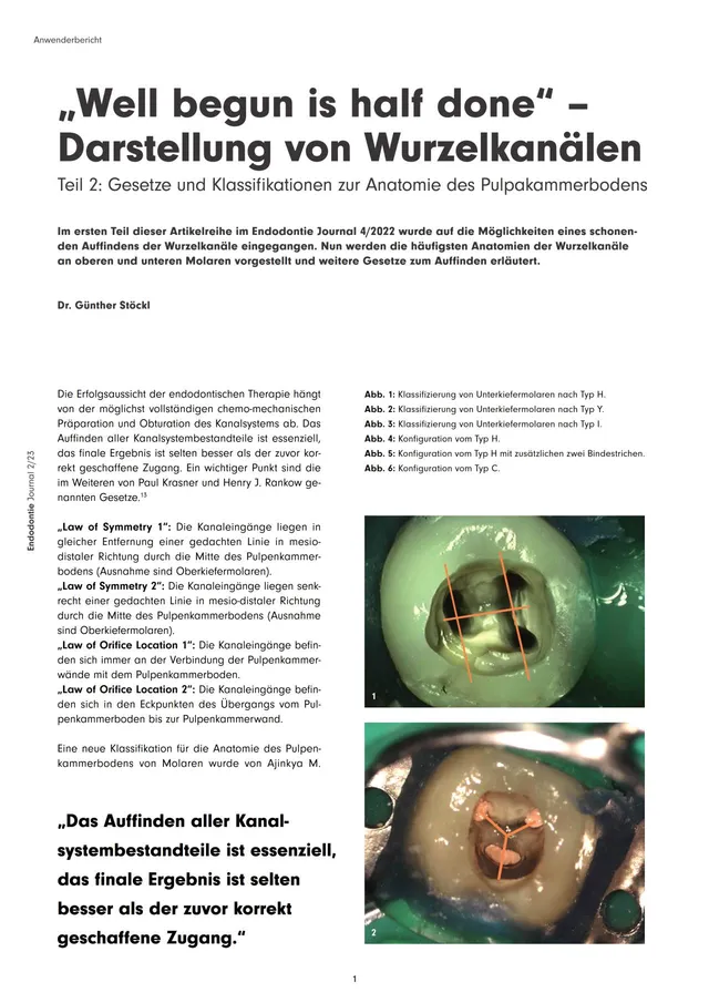komet-diao-fachbericht-wurzelkan-le-darstellung-endodontie image 1