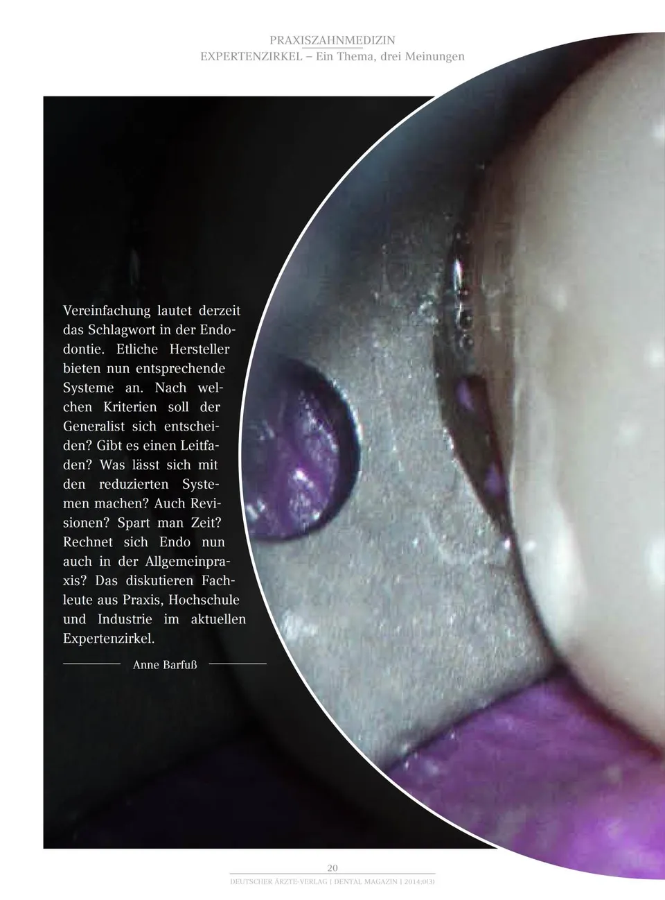 komet-fq-fachbericht-endodontie-wurzelkanal-einfachheit image 1