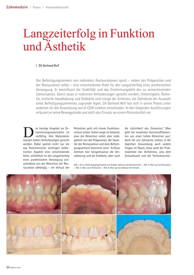 komet-fq-fachbericht-langzeiterfolg-befestigungszement-restauration image 1