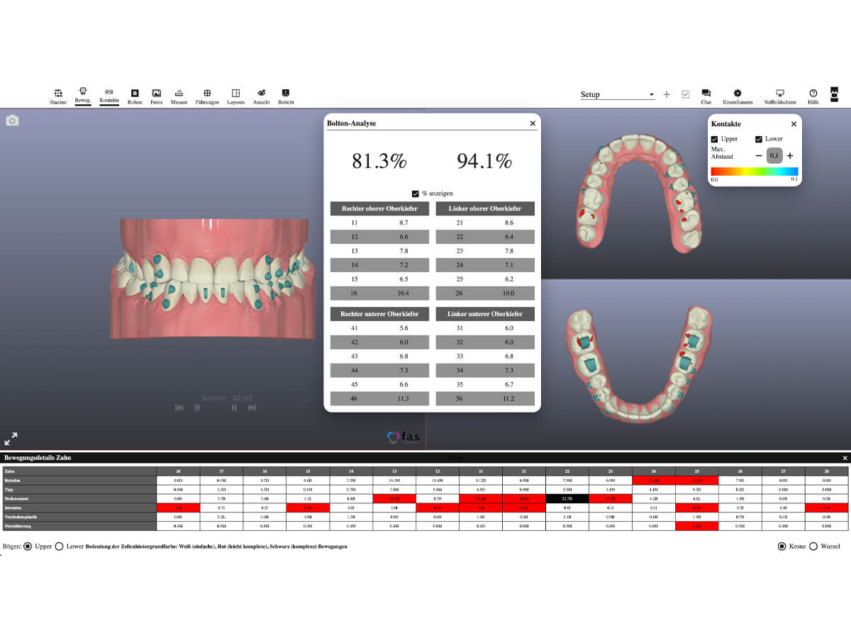 forestadent-fas-aligner-system-digitale-behandlungsplanung-wizard image 7
