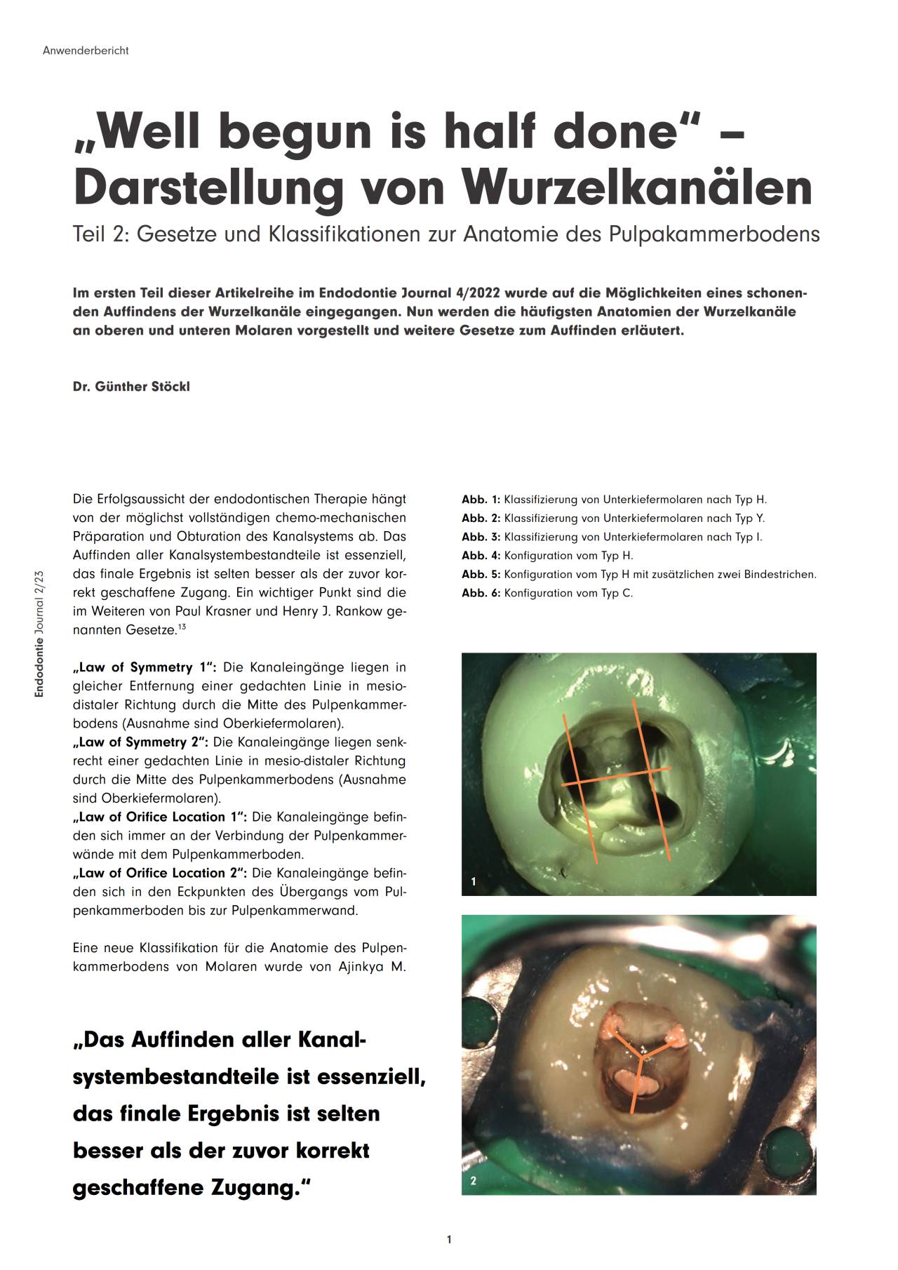 komet-diao-fachbericht-wurzelkan-le-darstellung-endodontie image 1