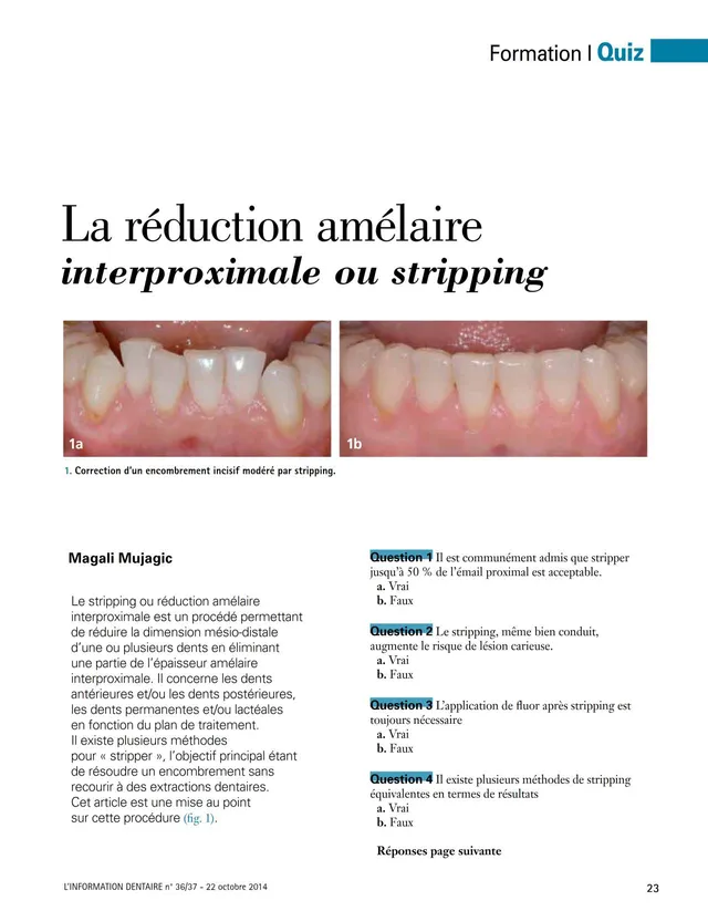 komet-dental-diao-quiz-schmelzreduktion-fachbericht-dr-mujagic image 1