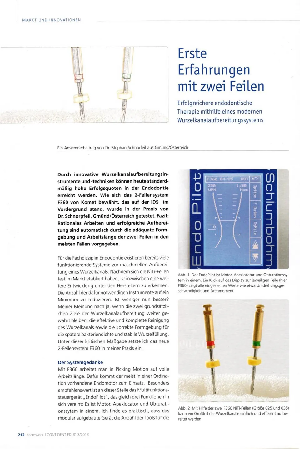 komet-fq-fachbericht-zwei-feilen-wurzelkanalaufbereitung-2013 image 1