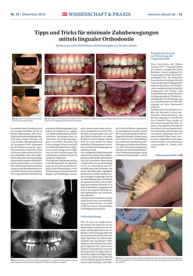 komet-dental-sonicline-spitze-linguale-orthodontie image 1