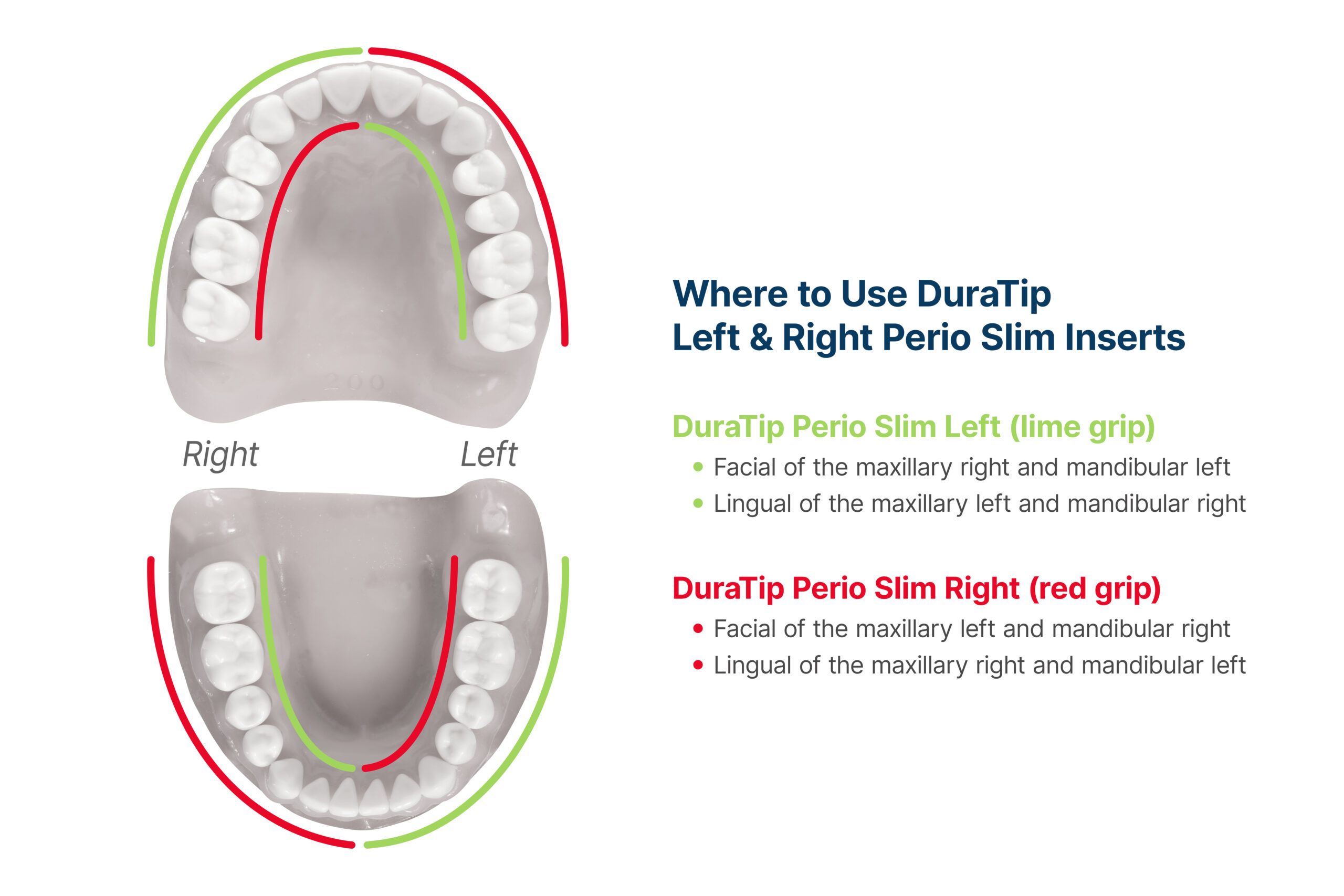 parkell-duratip-ultrasonic-eins-tze-scaling-soft-grip image 3