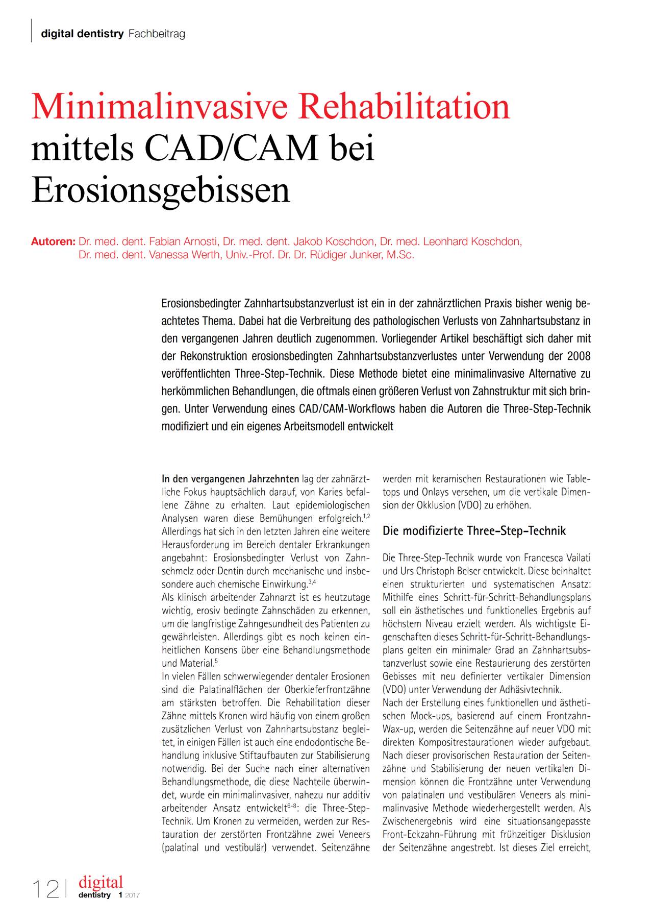 komet-diao-erosionsgebiss-fachbericht-cad-cam image 1