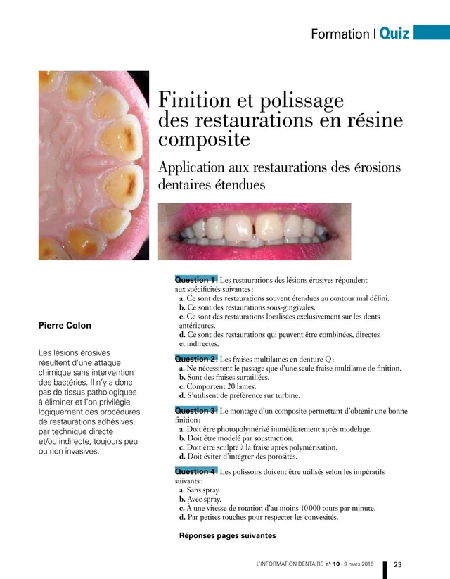 komet-dental-fq-fachbericht-composite-politur-quiz image 1