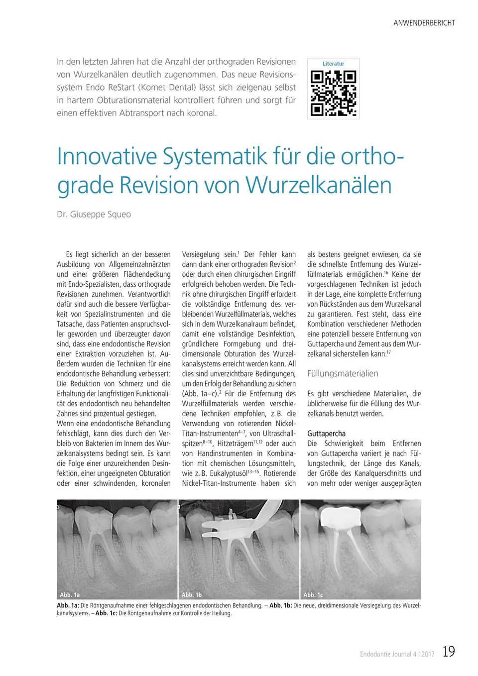 komet-dental-fq-fachbericht-orthograde-revision-wurzelkanal image 1