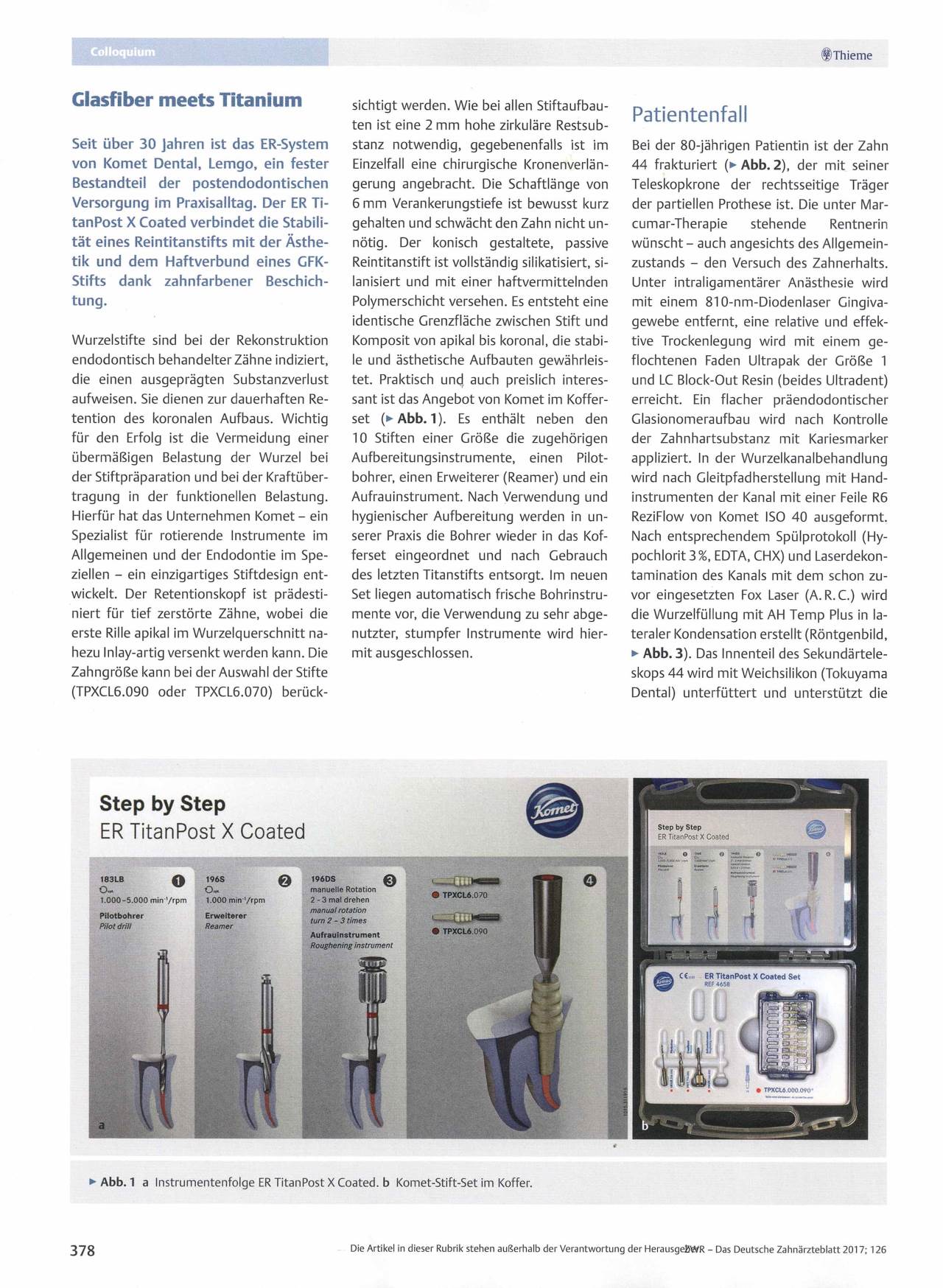 komet-cerapost-glasfiber-titan-stiftaufbau-bericht image 1