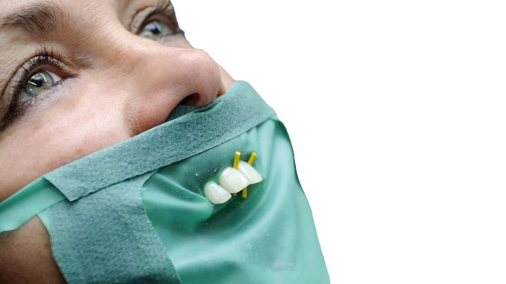 luxator-drydam-kofferdam-gesichtsmaske-zur-zahnisolierung image 3