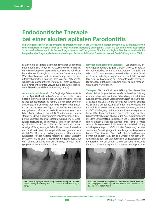 komet-fq-fachbericht-endo-therapie-f360-parodontitis image 1