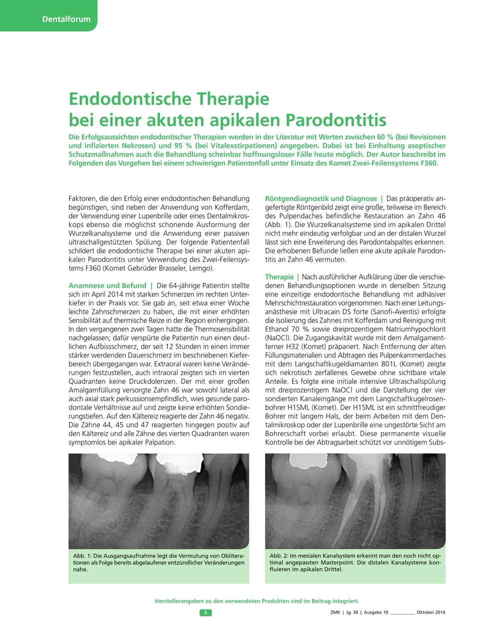 komet-fq-fachbericht-endo-therapie-f360-parodontitis image 1