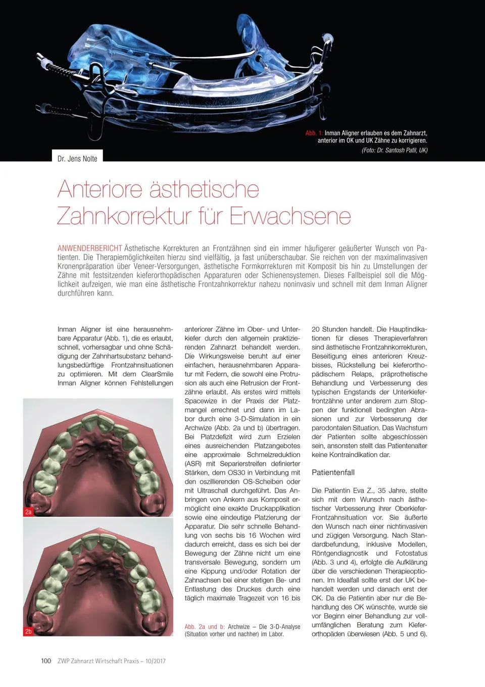 komet-diao-anterior-strips-frontzahn-sthetik image 1