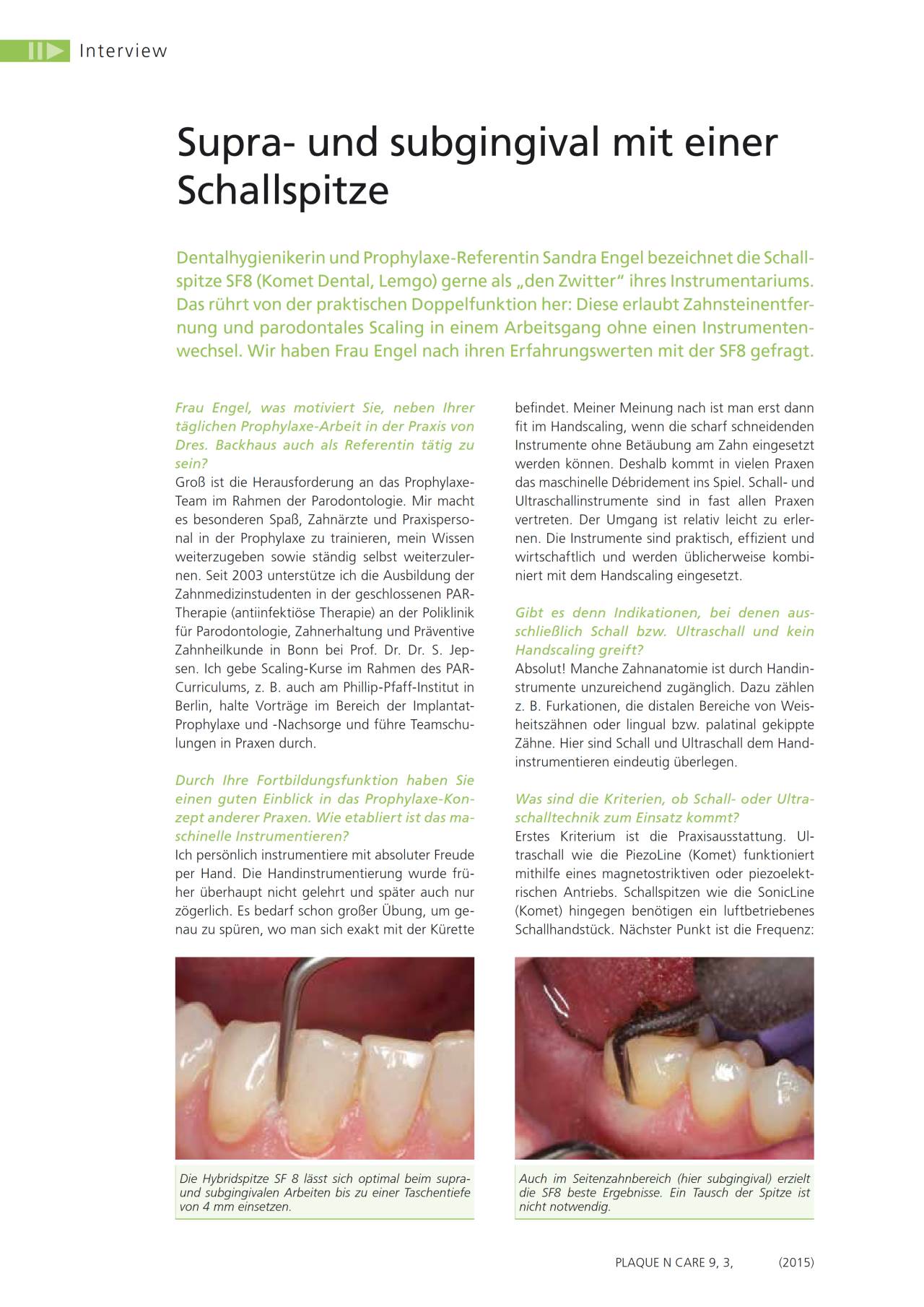 komet-dental-sonicline-schallspitze-fachbericht-prophylaxe image 1