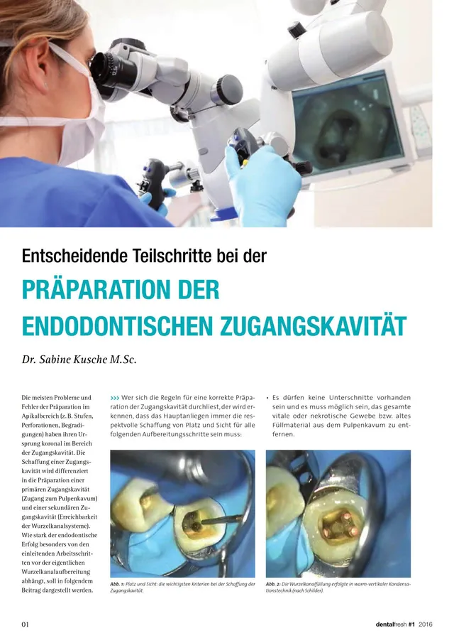 komet-dental-fq-fachbericht-zugangskavit-t-endodontie-kusche image 1